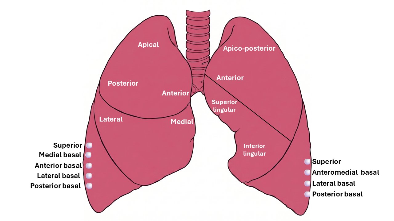 Bronchopulmonary segments of right and left lung — anterior view with all segments labelled
